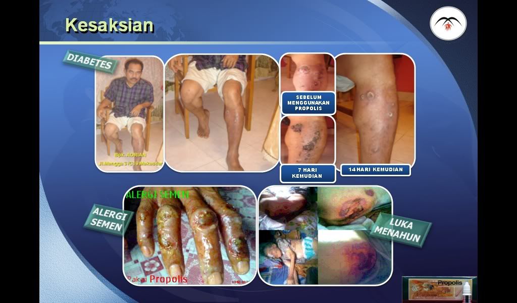 KESAKSIAN 2