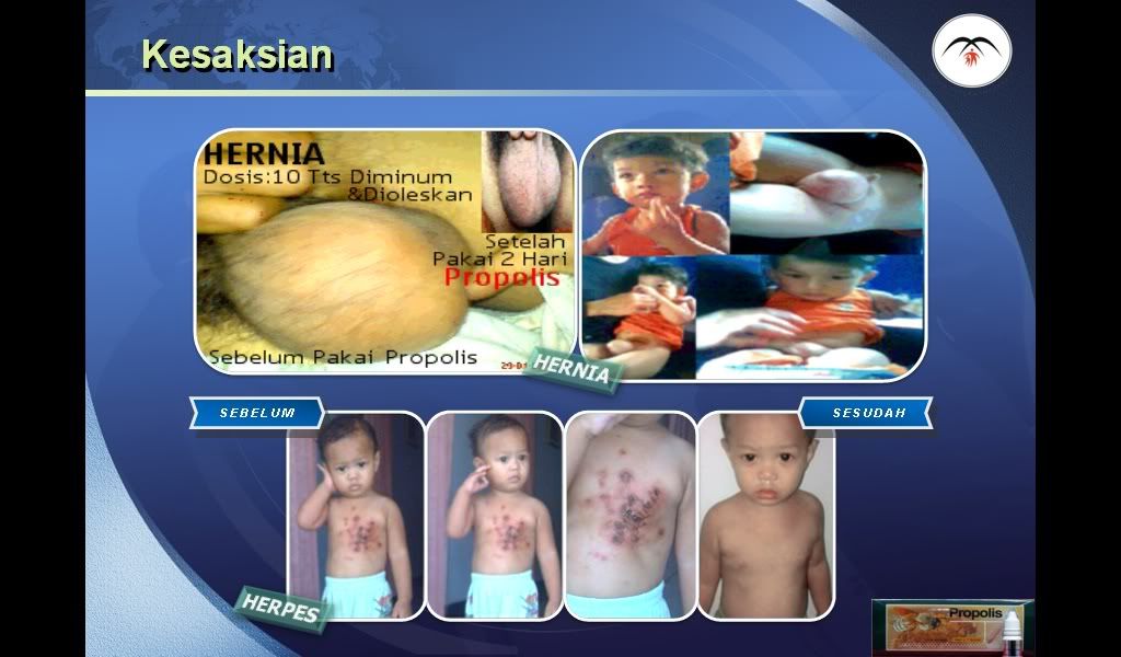 kesaksian 3
